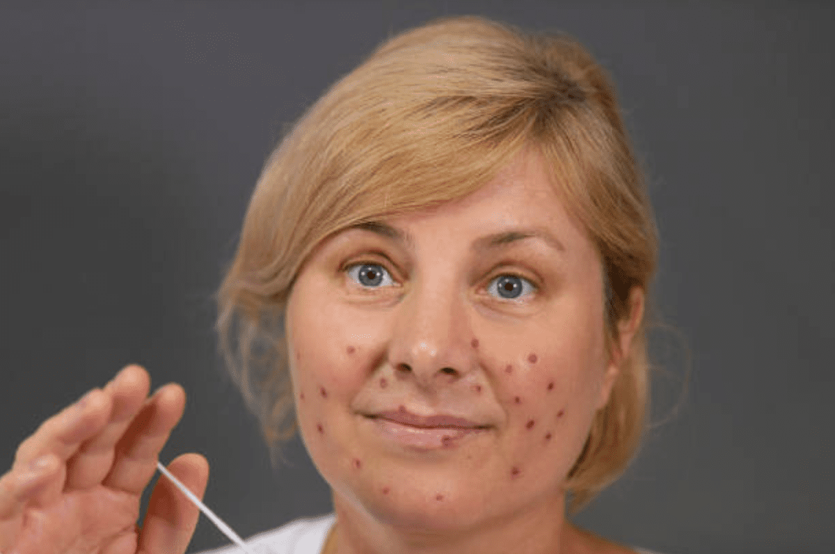 MH coaching for autoimmune management